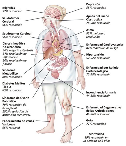 efectos de la cxbaria
