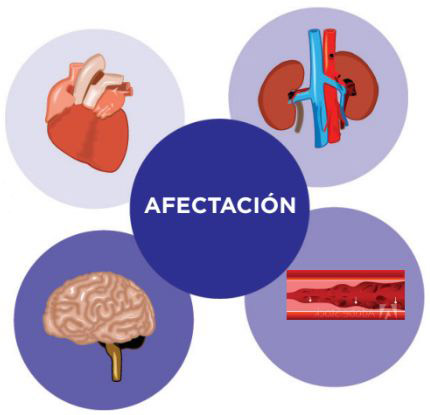 Afectación Hipertensión Arterial | Hospital Universitario Austral | Instituto de Cardiología y Terapéutica Cardiovascular